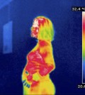 Thermography verus Mammography